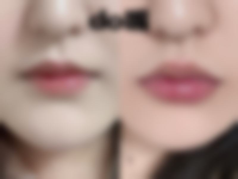 广州皇佳贝丽医疗美容门诊部治疗反馈与口碑评价。