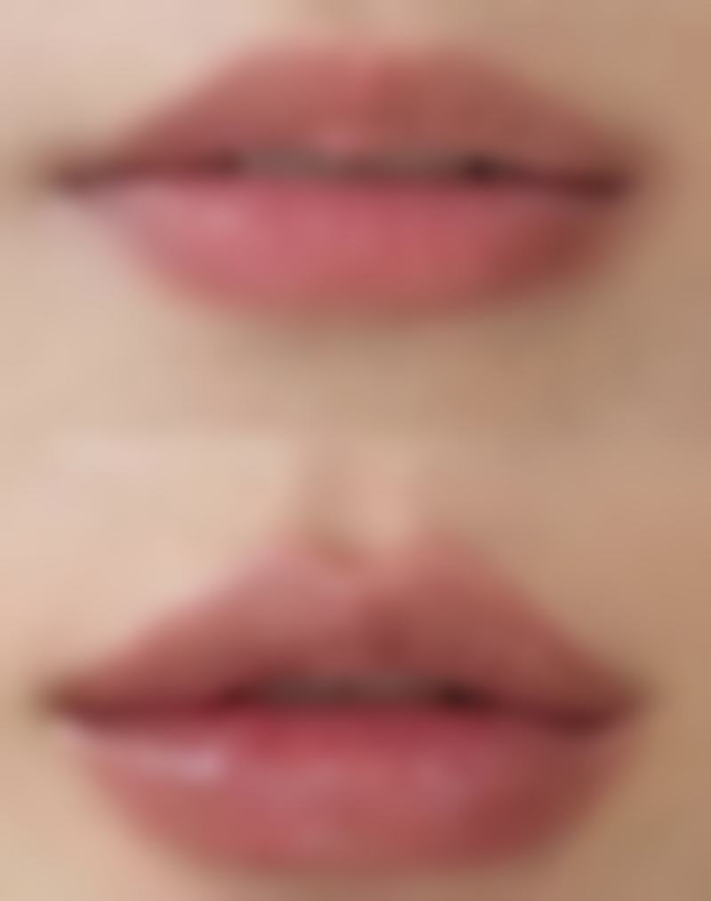 泗阳惠熙整形医院收费价格表