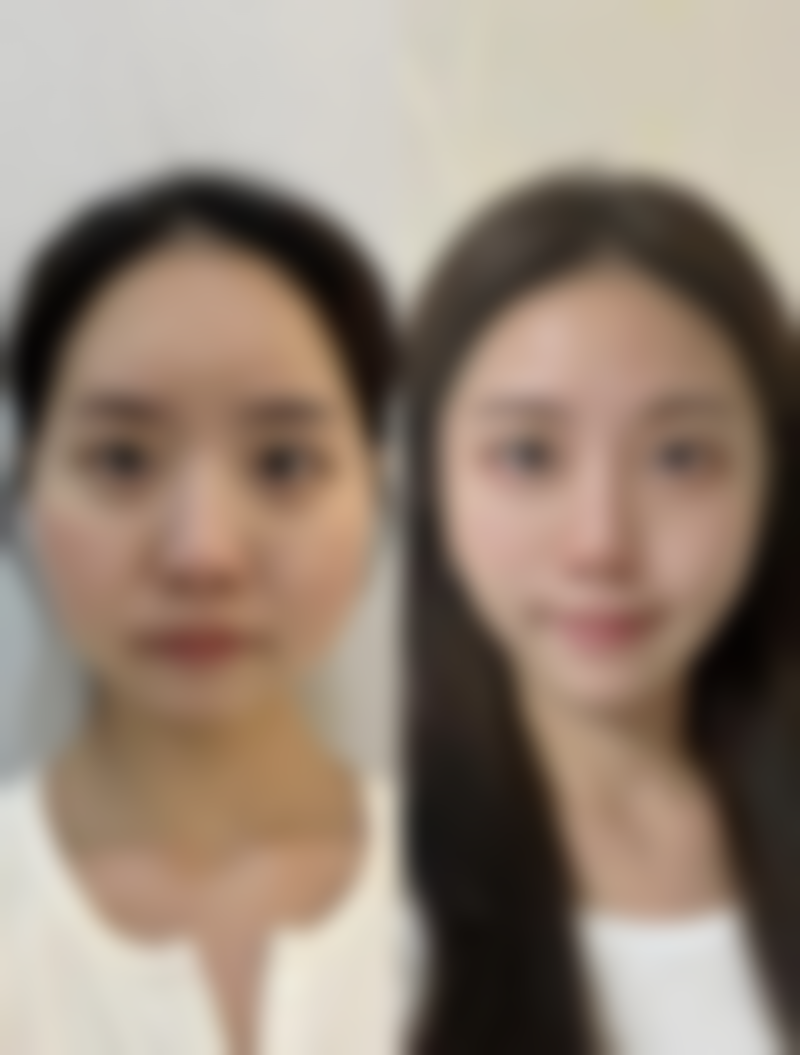 襄阳倍加美整形医院治疗反馈与口碑评价