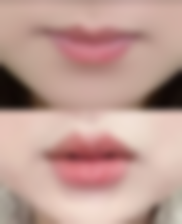 广州艺美医疗整形门诊部擅长项目。