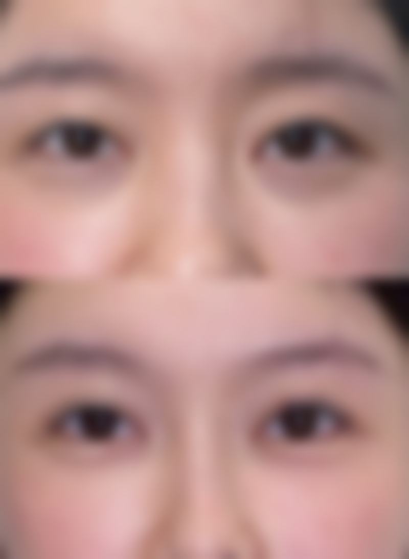 沈阳牛大夫植发医院预约挂号方式。