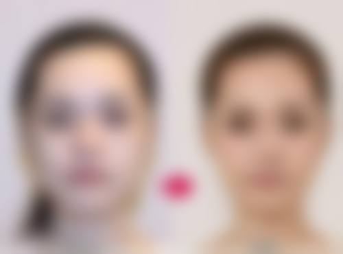 上海闵行维佳康泽瑞整形门诊部上班时间：