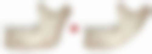 重庆奥斯蒂娜美容医院口碑评价与项目分享