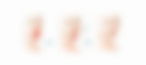 广州美咖整形医院擅长项目。