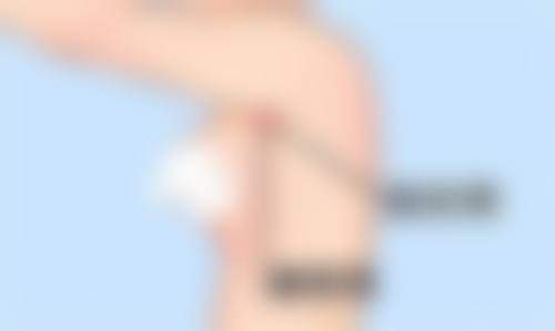 东莞圣美医疗美容口碑评价与项目分享