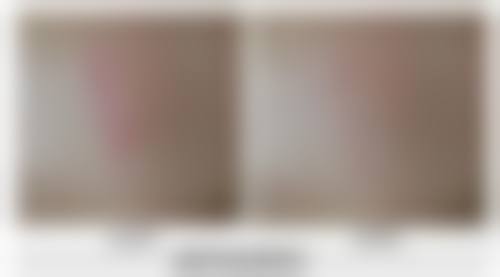 上海闵行维佳康泽瑞整形门诊部收费价格表