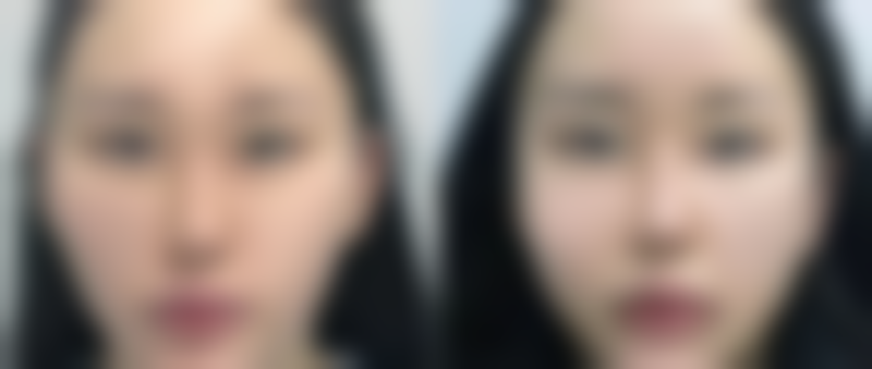 苏州同济整形美容医院的项目价格