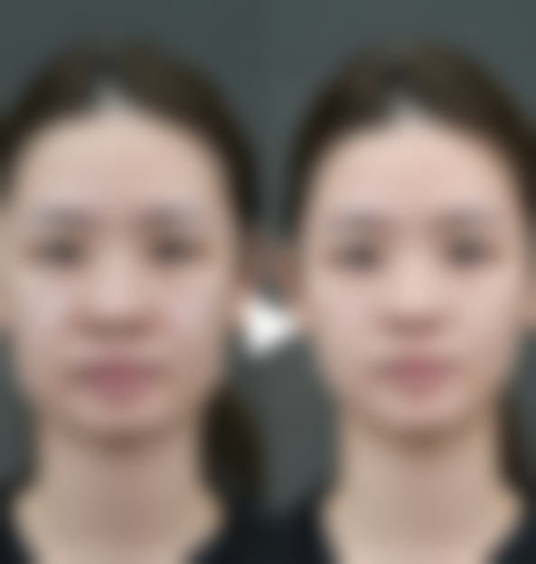 西安莎曼妃整形医疗美容医院擅长项目