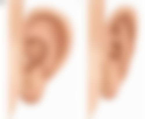 韩国ICo整形外科擅长项目。