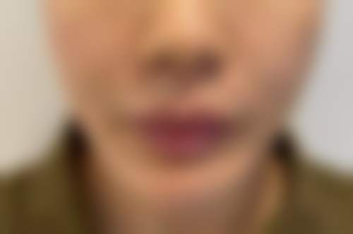 北京西美斯医疗美容诊所2026年价格收费表：