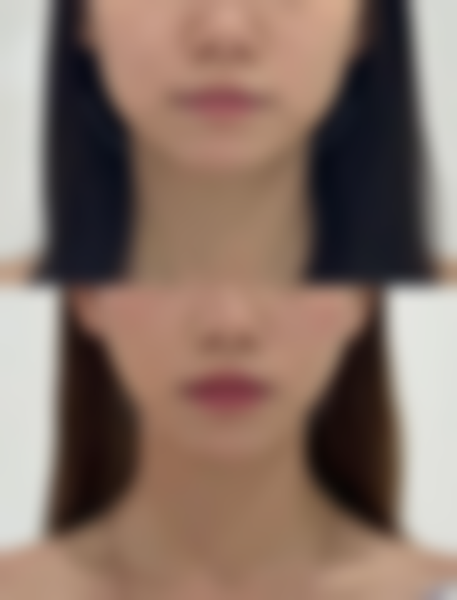 天长市人民医院(烧伤整形外科)治疗反馈与口碑评价。