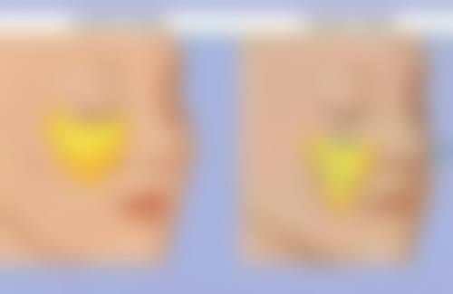 无锡花柒子医疗美容诊所擅长项目