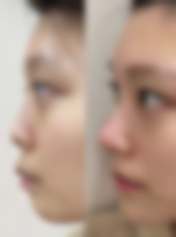 上海韩镜整形医院乘车路线: