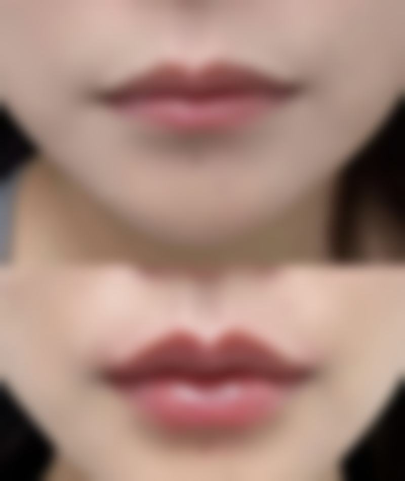 天津惟拉亚太医疗美容医院擅长项目。