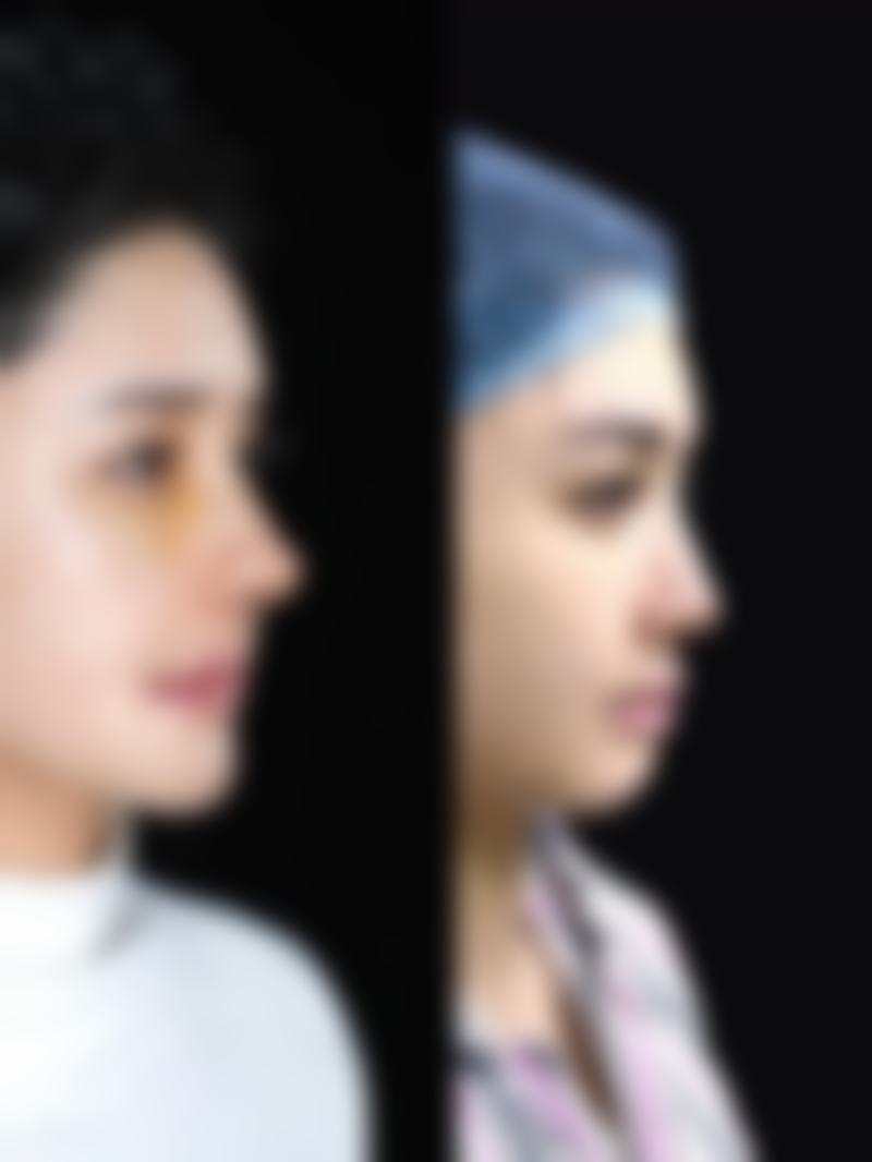 上海韩镜整形医院宗建华医生口碑评价与项目分享: