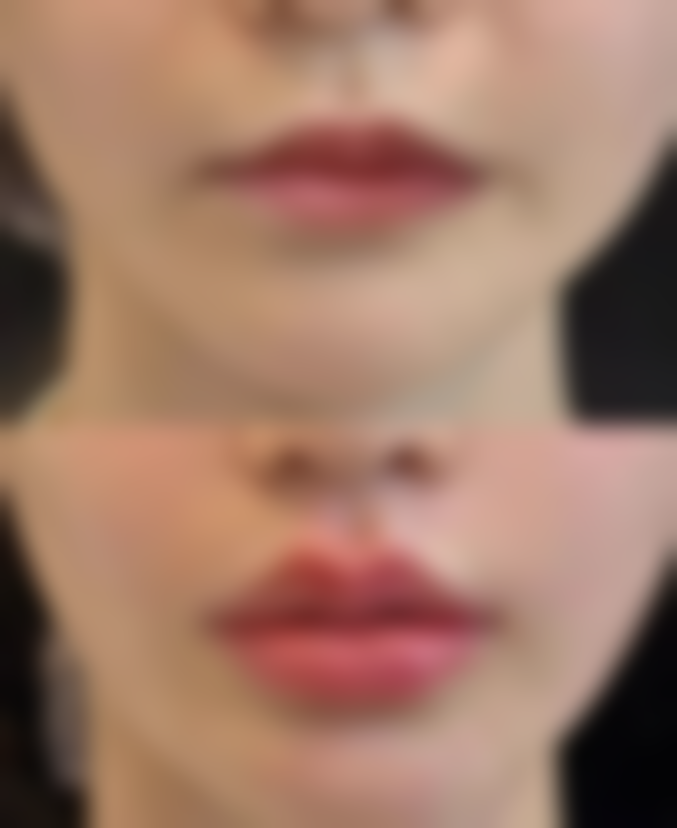 苏州100医院整形美容科口碑评价与项目分享：