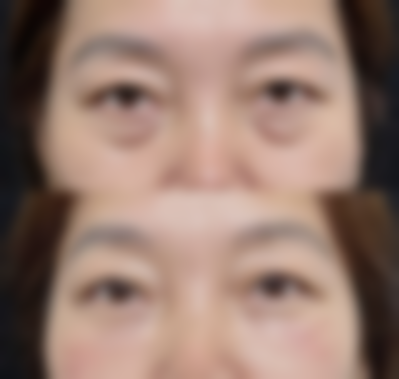 泉州阳光纯韩整形医生团队经验稳定