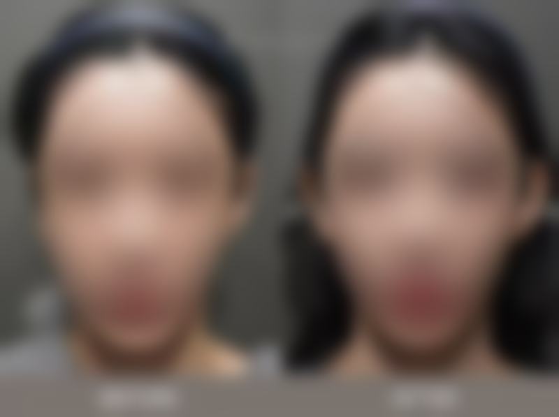 郑州安佳整形医院季晓燕医生技术怎么样