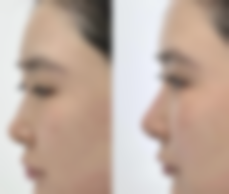 西安汝新美肌医疗美容诊所2026年价格收费表: