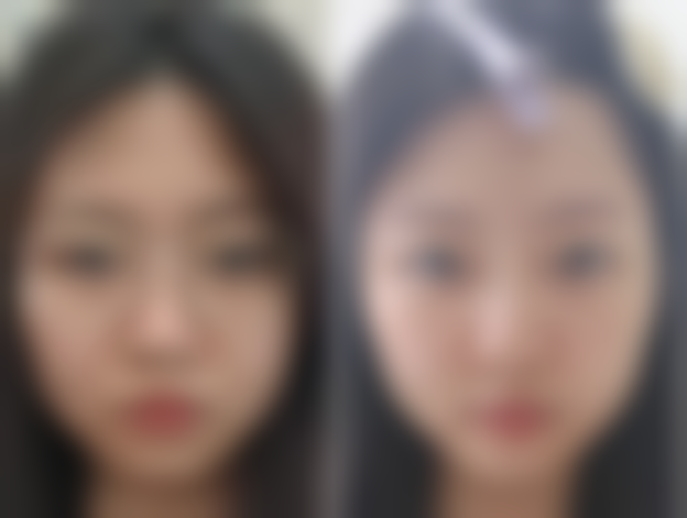 无锡花柒子医疗美容诊所口碑评价与项目分享：