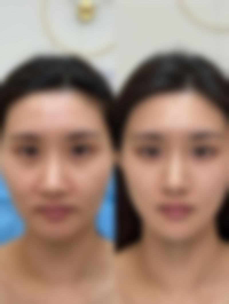 西安汝新美肌医疗美容诊所优势尽显。