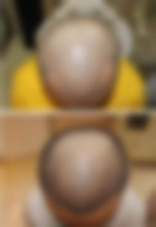 宋盈澄医生的技术实力