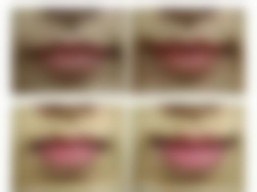 苏州爱思特整形医院门诊营业时间。