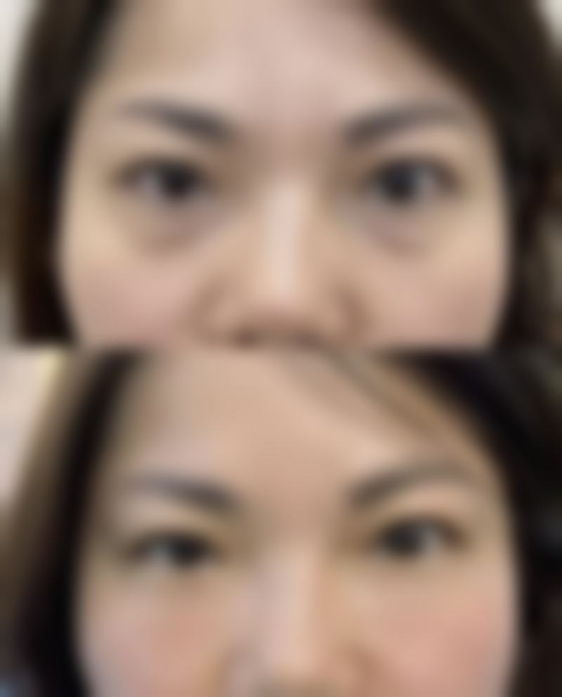济宁名美医疗美容医院擅长项目。