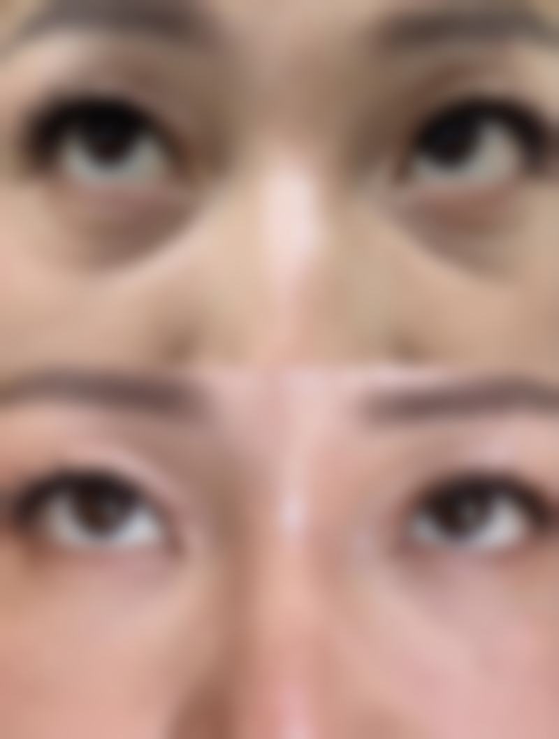 苏州爱思特整形医院治疗反馈与口碑评价。