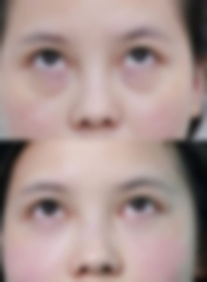 苏州爱思特整形医院擅长项目。