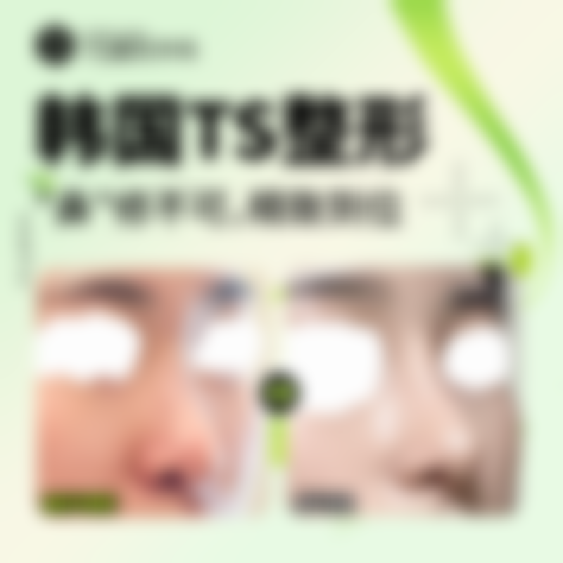 济宁名美医疗美容医院项目优势。