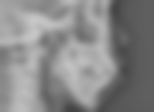 新疆华莉丝医疗美容门诊部口碑评价与项目分享: