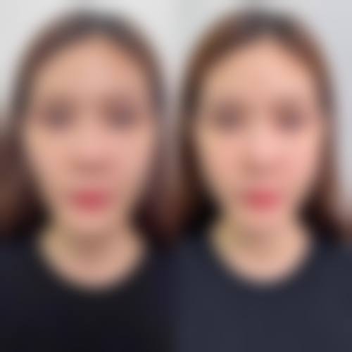 马永光医生的技术实力