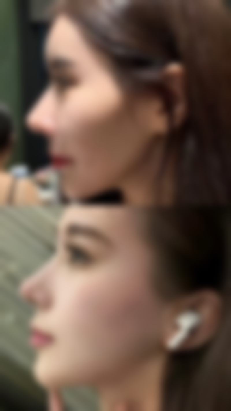 南京星美美容医院治疗反馈与口碑评价怎么样?