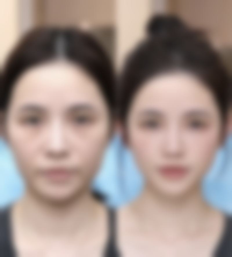 蚌埠韩美美莱医疗美容门诊部口碑评价