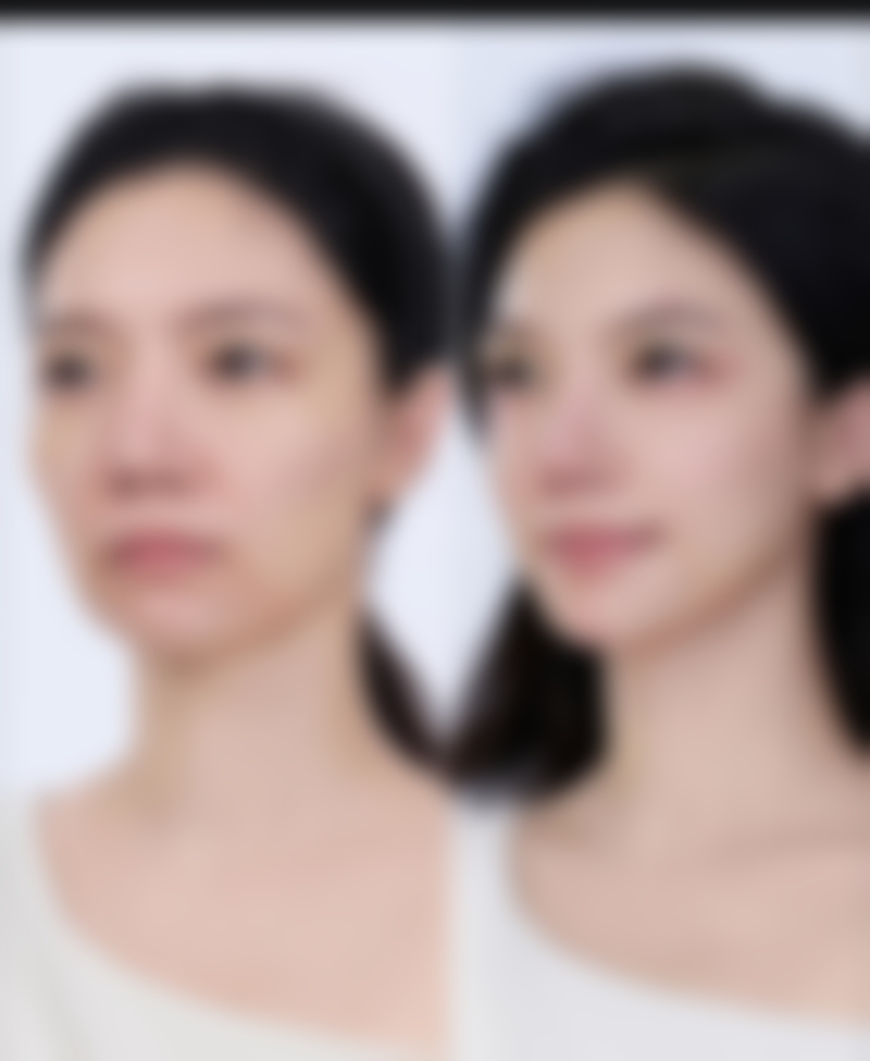 南宁格林美菲整形预约挂号方式。