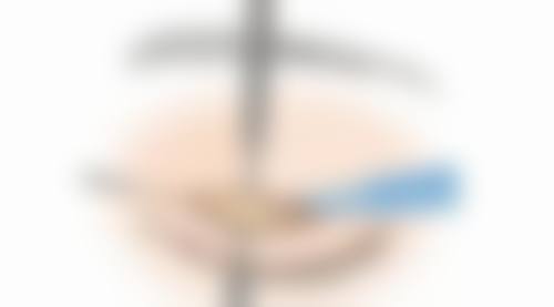 南通臻瑷美整形医院擅长项目。