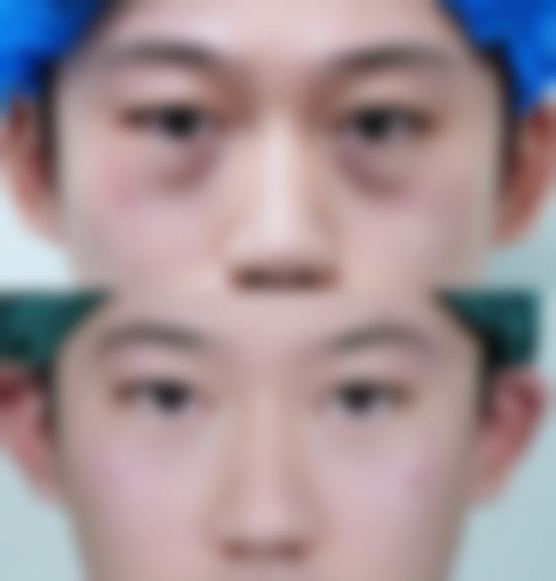 南通臻瑷美整形医院治疗反馈与口碑评价。