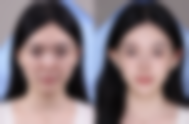 南通臻瑷美整形医院2026年价格收费表：