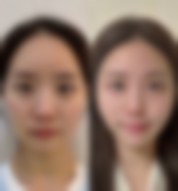 东莞南华妇科医院妇科整形擅长项目。