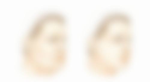 宜昌卓雅整形医院预约挂号