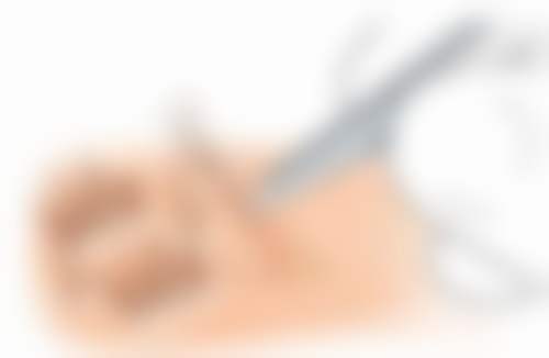 北京唐人美天医疗美容医院治疗反馈与口碑评价。