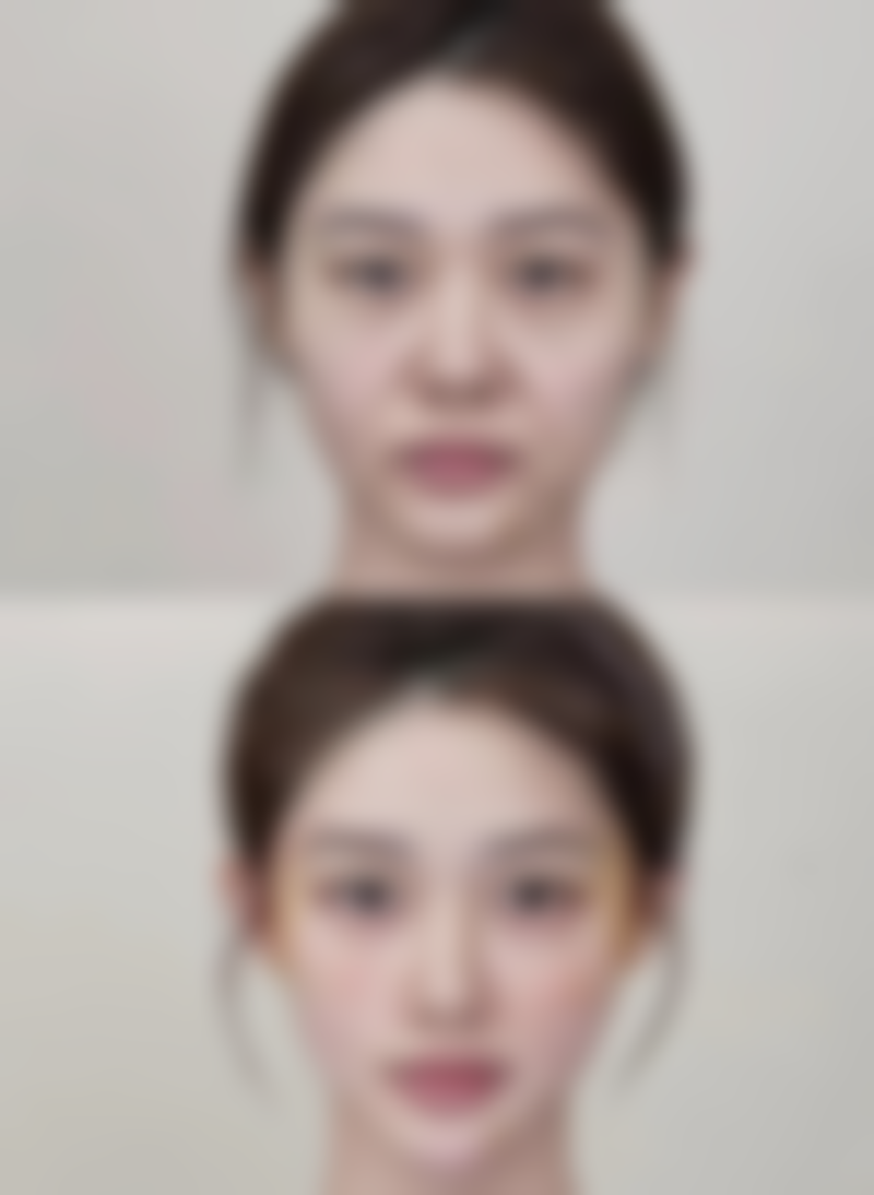 秦皇岛贝值医疗美容口碑评价与项目分享：