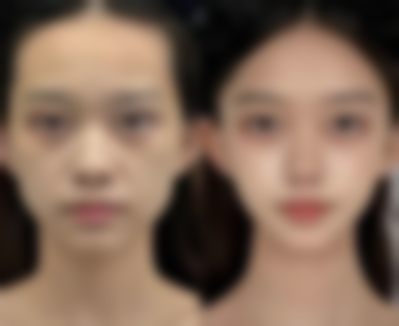 太原倾城医疗美容诊所医生团队经验稳定。