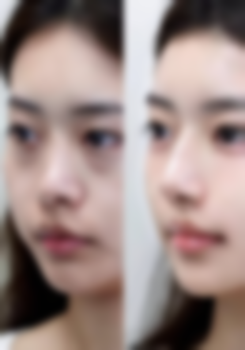 盘州佳颖整形医院治疗反馈与口碑评价