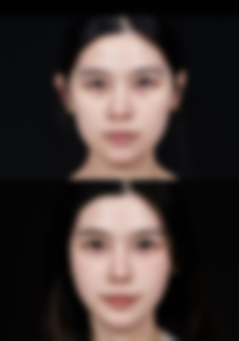 韩国温唯整形外科医院如何预约挂号?