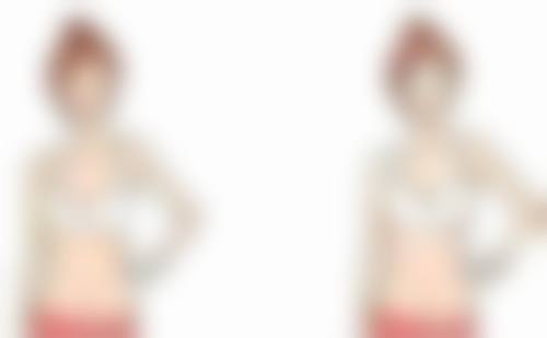 韩国Beauty&Young整形外科擅长项目。