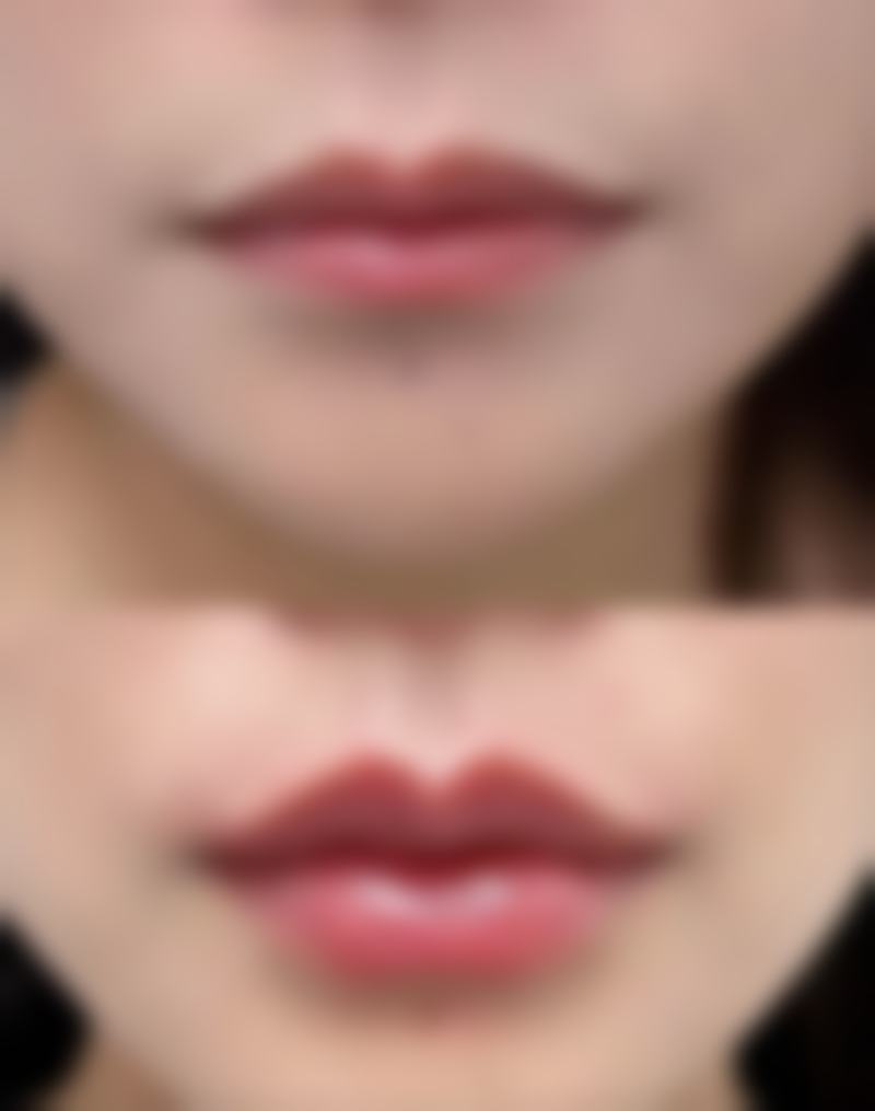 河北保定白沟姮美整形医疗美容中 心乘车路线