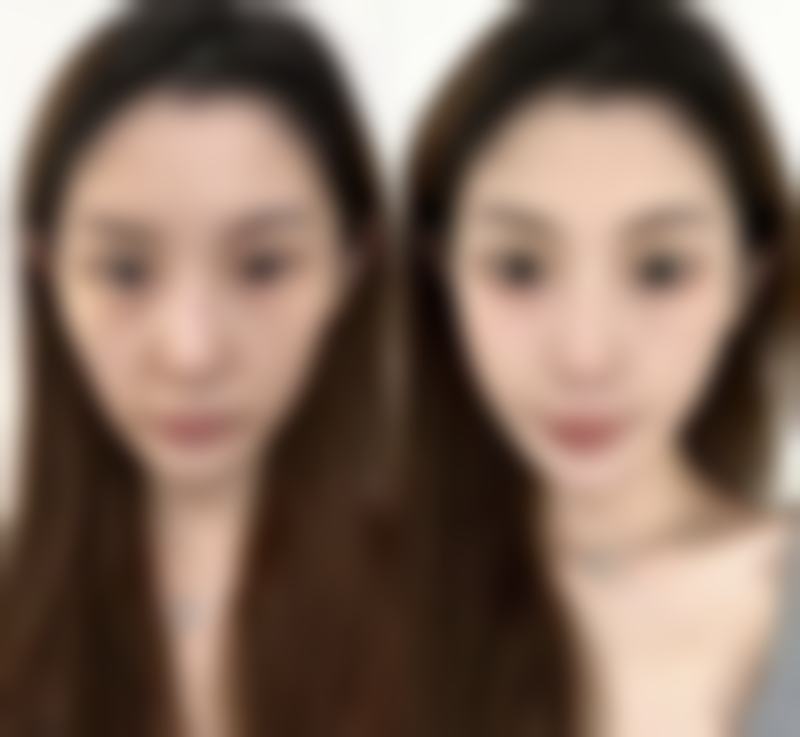 衢州梦颜清整形医院擅长项目。