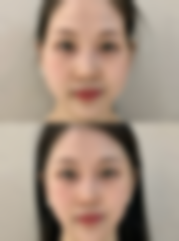 嘉兴禾美医疗美容整形医院治疗反馈与口碑评价。